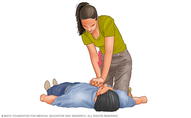 cpr-chest-compressions-illustration-8col-3678934-3c