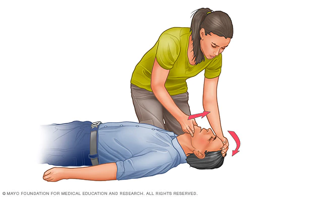 cpr-tilt-head-illustration-8col-3678934-2a